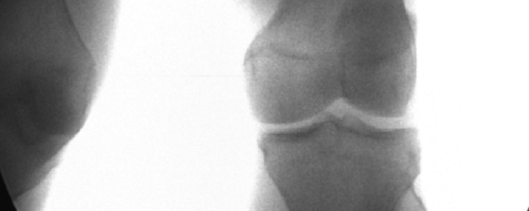 Photo of knee scan