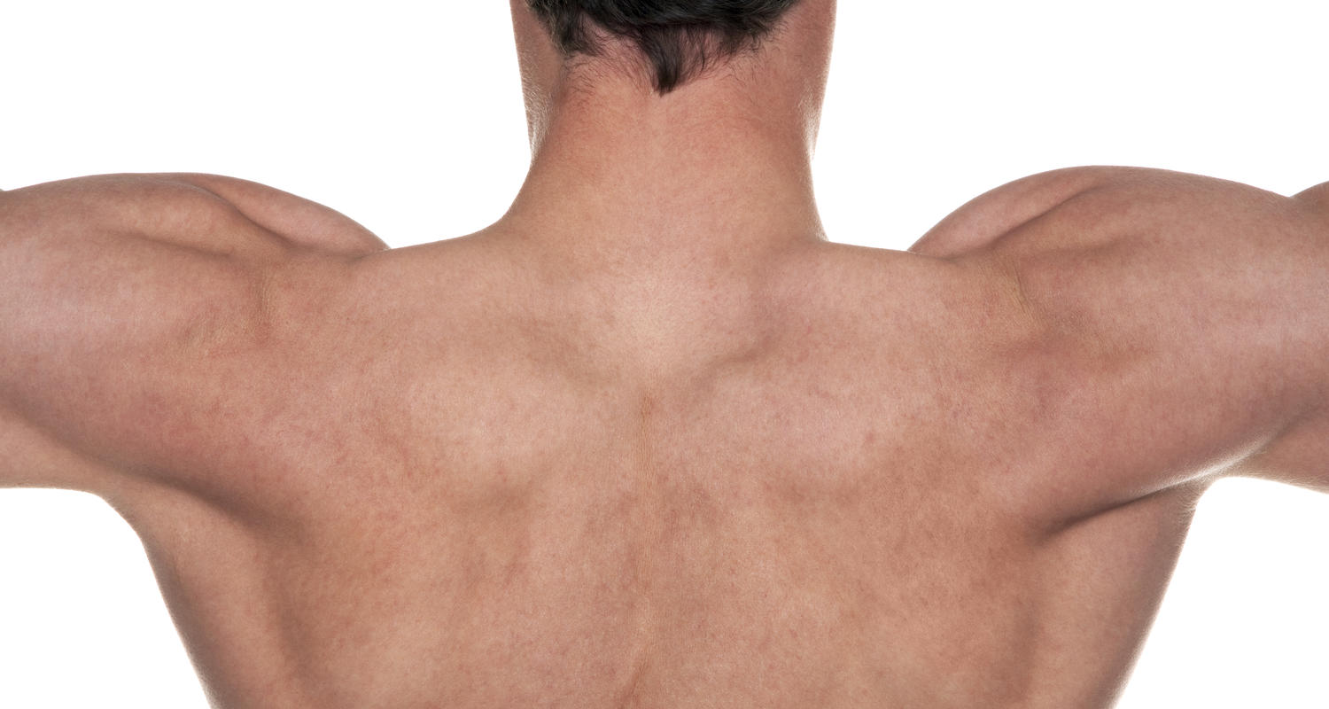 shoulders