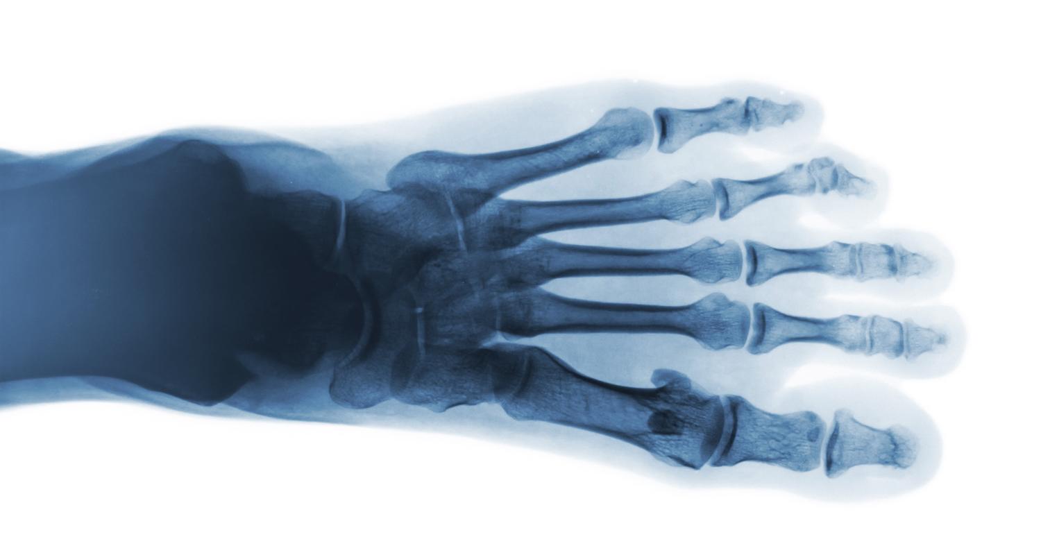foot