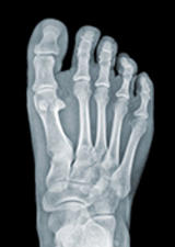foot xray