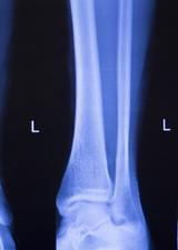 leg xrays