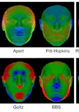 3D facial scans